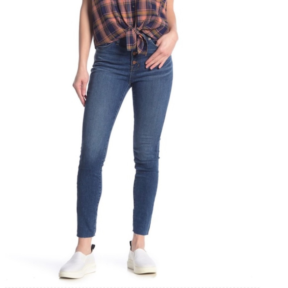 NEW Madewell Button Fly Mid Rise Skinny Jeans